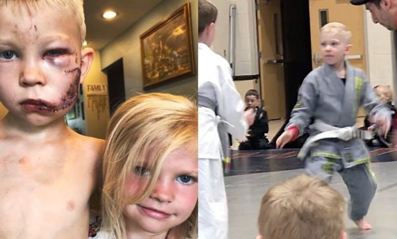 Heroic 6-Year-Old BJJ Practitioner Saves Sister From Dog Attack