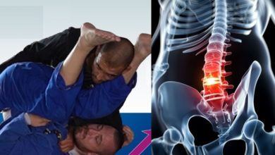 Can You Train Jiu-Jitsu with a Herniated Disc? BJJ Black Belt Shares His Experience