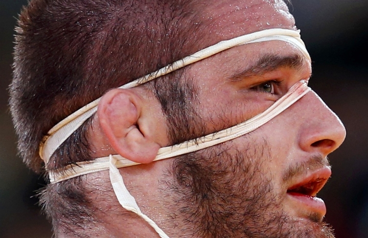 Travis Stevens: “After A Concussion I couldn’t Walk in a Straight Line, Remember What I Ate or Day Of The Week”