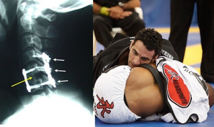 Braulio Estima raconte le temps qu'il a gagné aux Européens de l'IBJJF malgré une grave blessure au cou