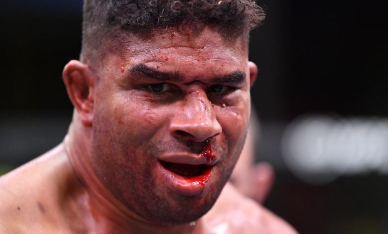 UFC Vegas: Overeem contre Volkov med. suspensions - Quatre combattants risquent 6 mois en raison de blessures à la main