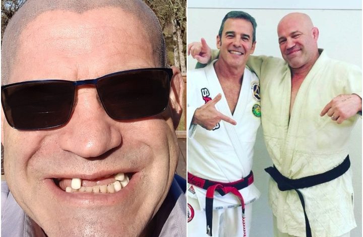 Mark Schultz, Olympic Wrestling Champ Needs Help To Restore His Teeth