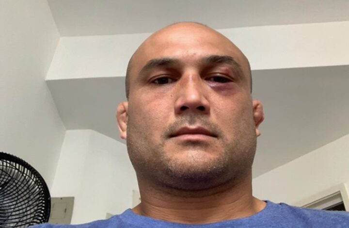 B.J. Penn: “CTE Is Fake, A Lie Used To Cover Up Murders”