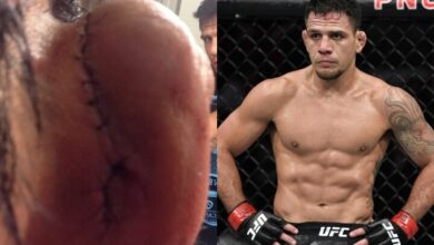 Rafael Dos Anjos Reveals That His Ear Almost Fell Off Before Fight With Khabib