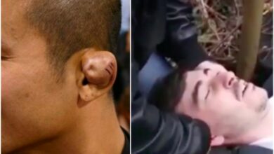 Madness: Grapplers Giving Themselves Cauliflower Ears To Look Tougher