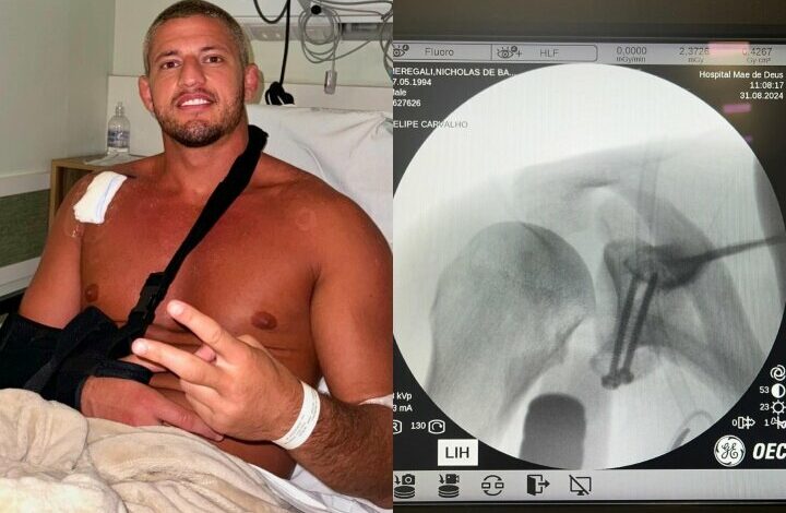 Nicholas Meregali Undergoes Surgery After Serious Injury: “I’m At Peace”