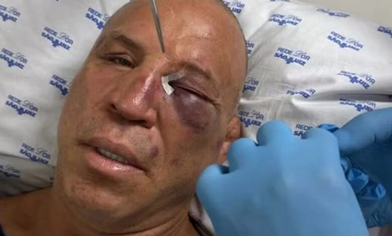 Wanderlei Silva hospital