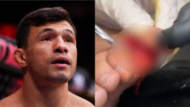 Alessandro Costa enters the Octagon for his fight against Alden Coria at Noche UFC, opposite a graphic, blurred image of Costa's toe injury