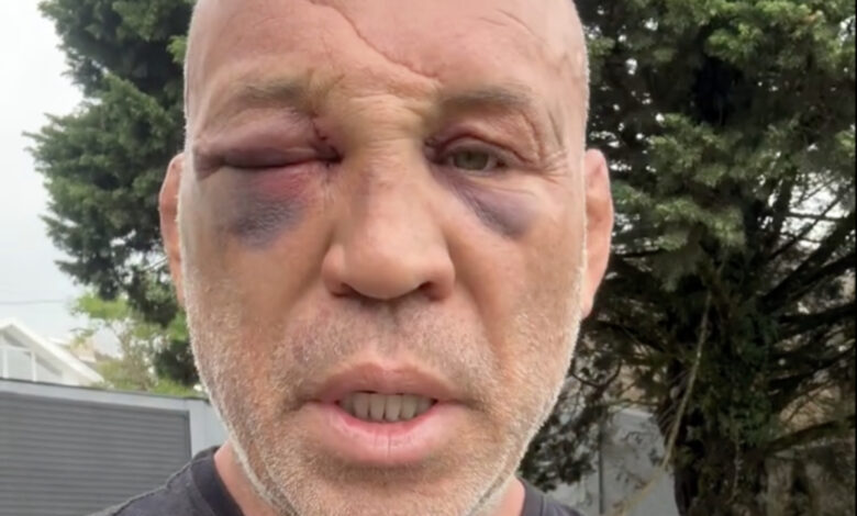 Wanderlei Silva after post-fight KO