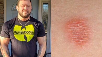 Tom DeBlass Calls Out Training With Skin Infections: “A Selfish Move”